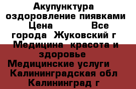 Акупунктура, оздоровление пиявками › Цена ­ 3 000 - Все города, Жуковский г. Медицина, красота и здоровье » Медицинские услуги   . Калининградская обл.,Калининград г.
